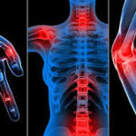Paediatric Rheumatology 